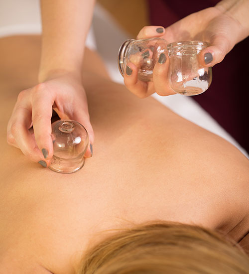 Cupping Therapy