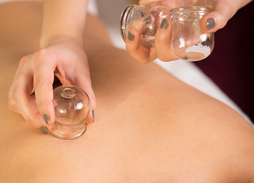 Cupping Therapy